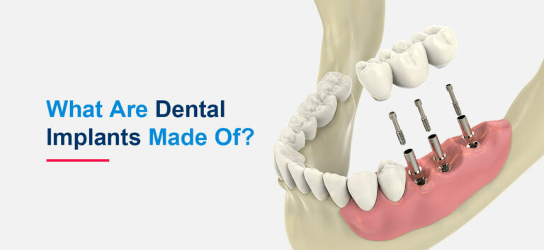 What Are Dental Implants Made Of?